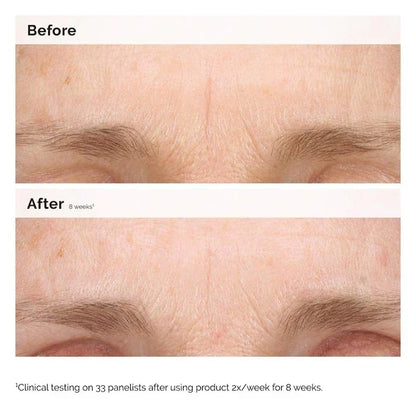 The Ordinary Retinal 0.2% Emulsion Serum